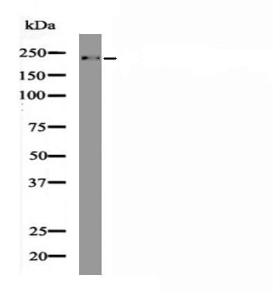 Anti-Phospho-Myosin-9/MYH9 (Ser1916) Polyclonal Antibody