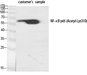 Anti-Acetyl-NF-kB p65 (Lys310) Polyclonal Antibody