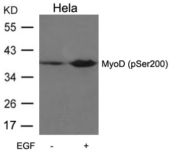 Anti-Phospho-MyoD (Ser200) Polyclonal Antibody
