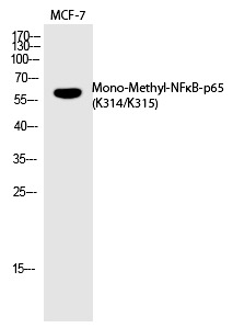 Anti-Mono-methyl-NF-kB p65 (Lys314, 315) Polyclonal Antibody