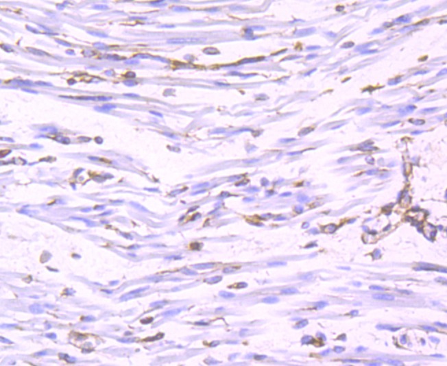 Anti-RTN4 Antibody (3H783)