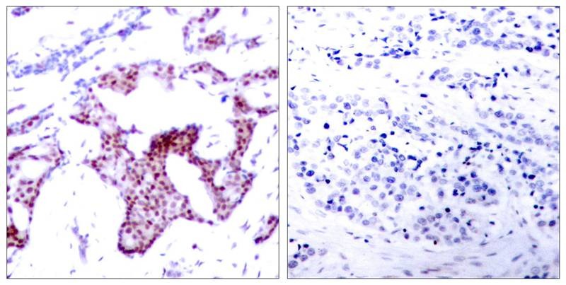 Anti-Phospho-NF-kB p65 (Ser276) Polyclonal Antibody 2