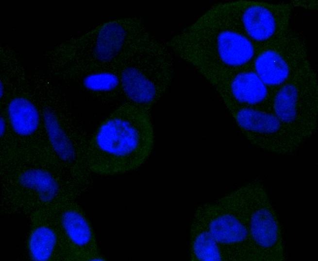 Anti-NGF Antibody (9K780)