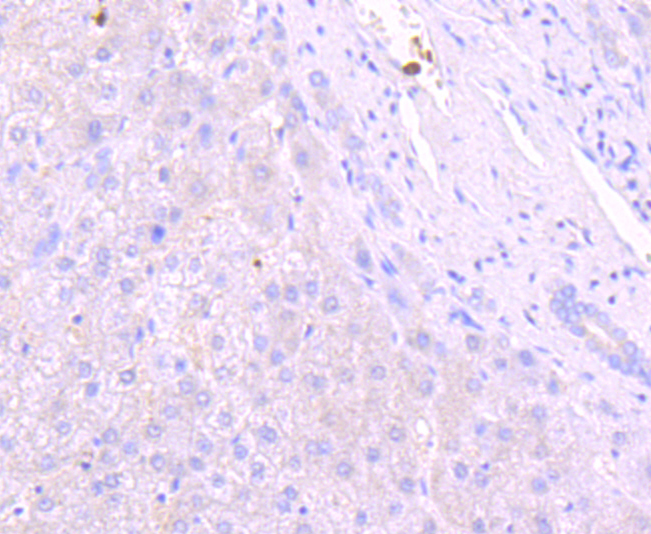 Anti-Lipocalin-2/LCN2 Antibody (7O248)