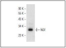 Anti-NGF Antibody (3Q103)