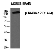 Anti-Phospho-NMDAR2B (Tyr1474) Polyclonal Antibody