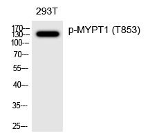 Anti-Phospho-MYPT1 (Thr853) Polyclonal Antibody