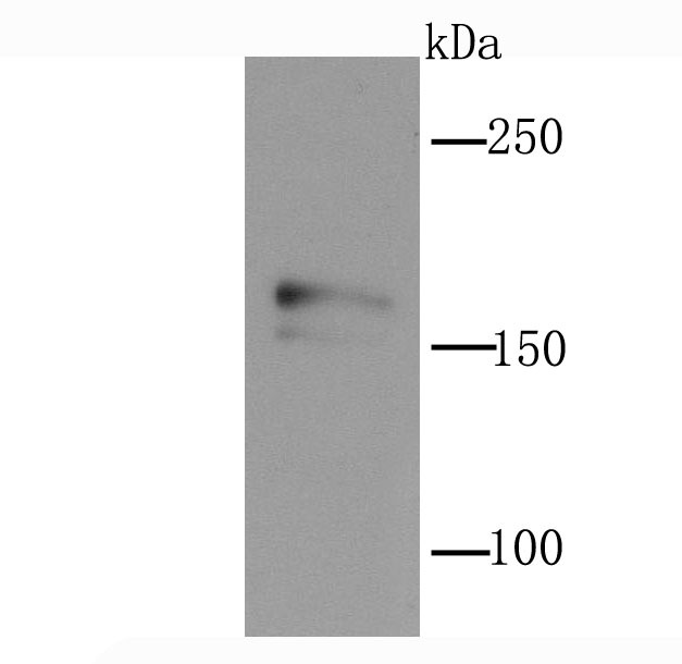Anti-NMDAR2A Antibody (4O151)