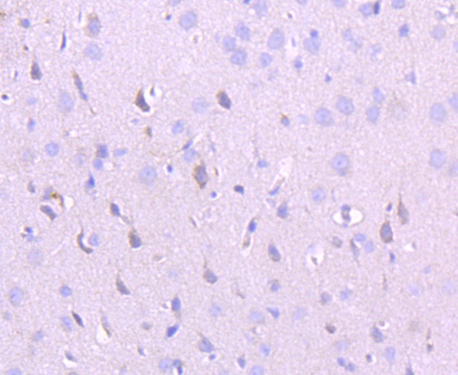 Anti-NMDAR2A Antibody (4O151)