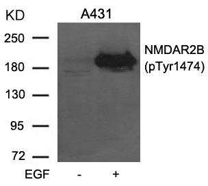 Anti-Phospho-NMDAR2B (Tyr1474) Polyclonal Antibody 2