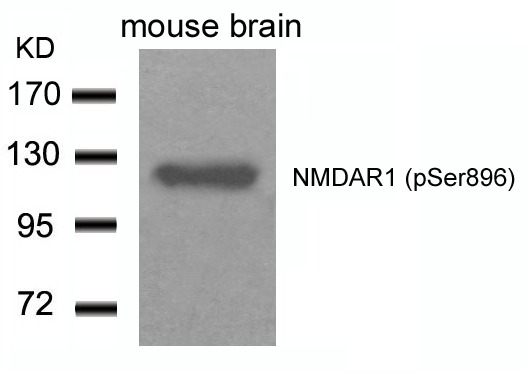 Anti-Phospho-GRIN1 (Ser896) Polyclonal Antibody 2