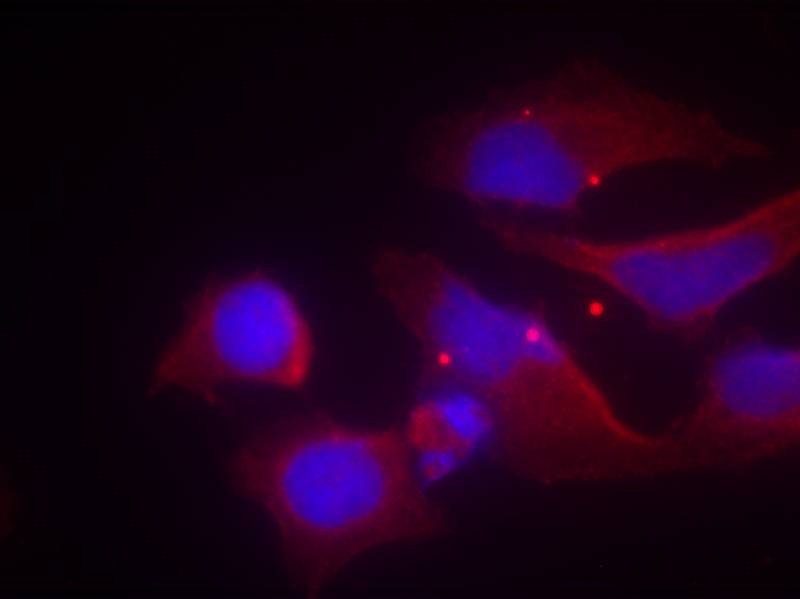 Anti-Phospho-NMDAR2B (Tyr1474) Polyclonal Antibody 2