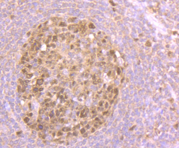 Anti-Nesprin 1 Antibody (1Z207)