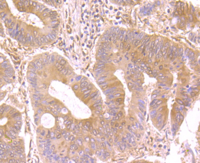 Anti-Nesprin 1 Antibody (1Z207)