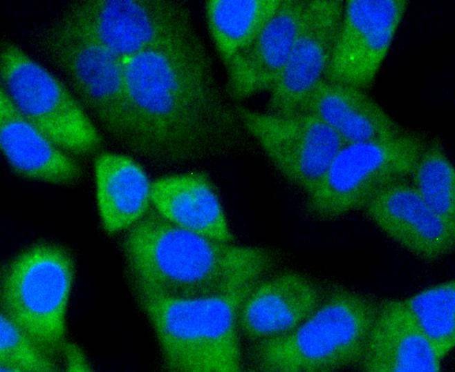 Anti-Notch 1 Antibody (6A911)
