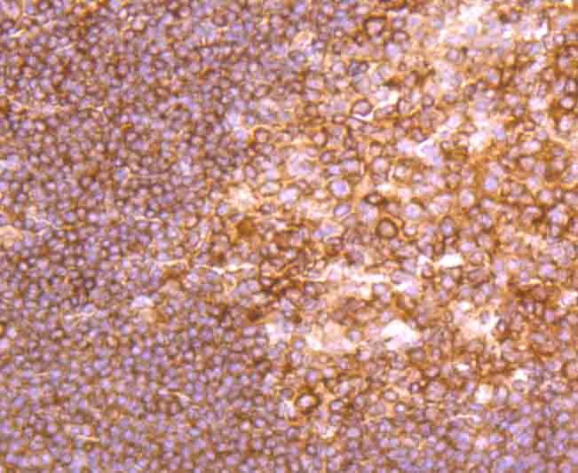Anti-NFkB p100 Antibody (1L126)