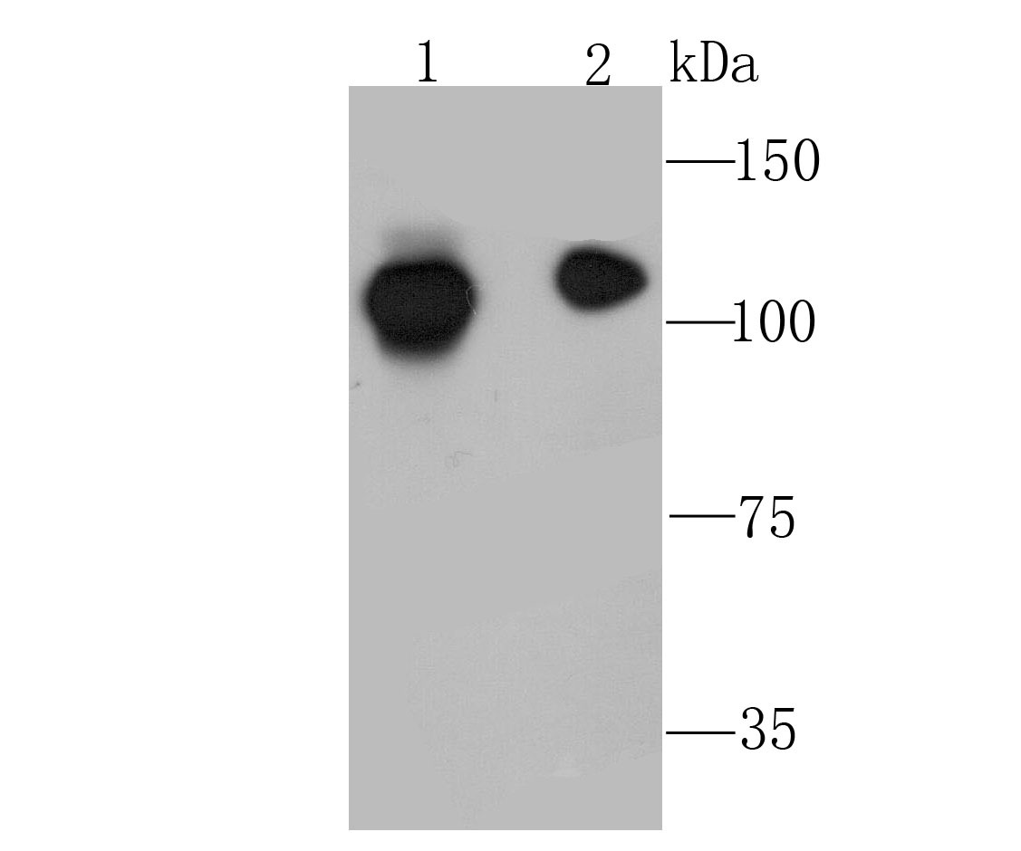Anti-NFkB p100 Antibody (1L126)