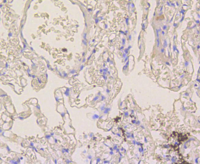 Anti-Notch 1 Antibody (6A911)