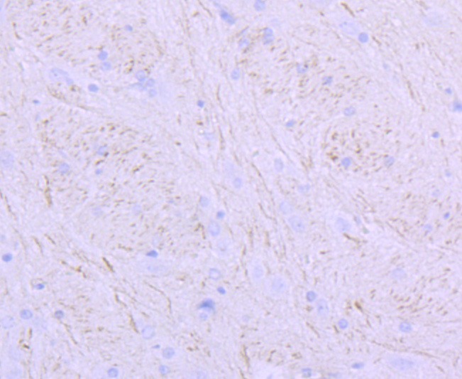 Anti-NEFM Antibody (7Y5)