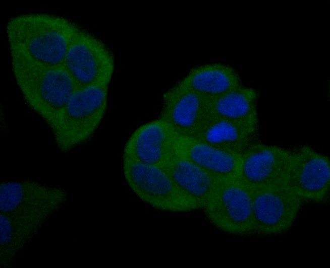 Anti-NFkB p100 Antibody (1L126)