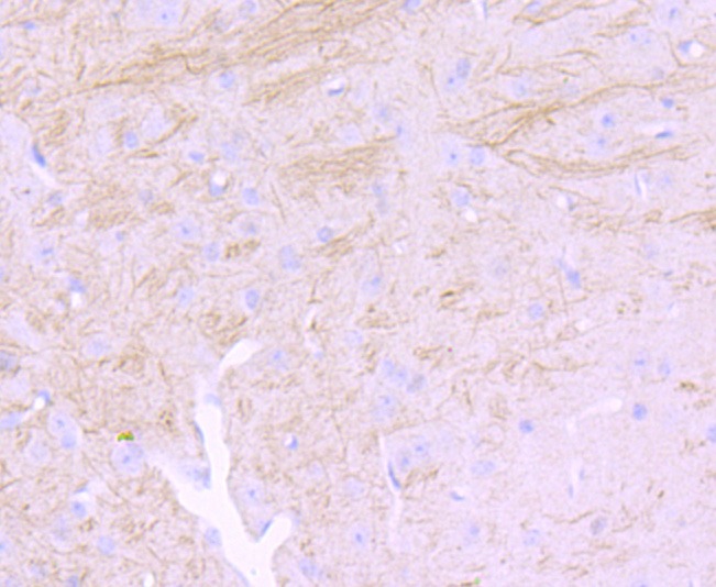 Anti-NEFM Antibody (7Y5)