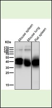 Anti-NFKB1 Antibody (3N127)