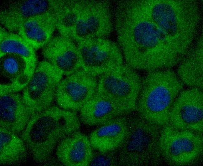 Anti-NFkB p100 Antibody (1L126)