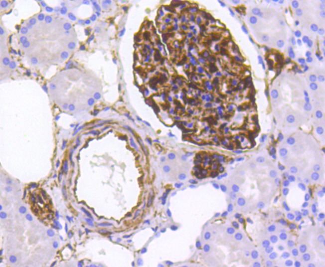 Anti-Nestin/NES Antibody (7Y567)