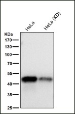 Anti-NFKB1 Antibody (3N127)
