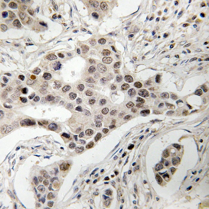 Anti-Phospho-NCOA2 (Ser736) Polyclonal Antibody