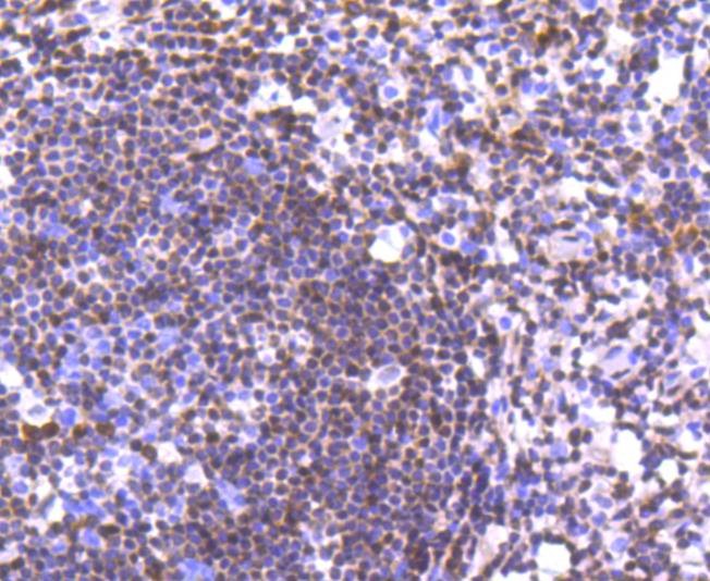 Anti-CDKN1B Antibody (9B660)