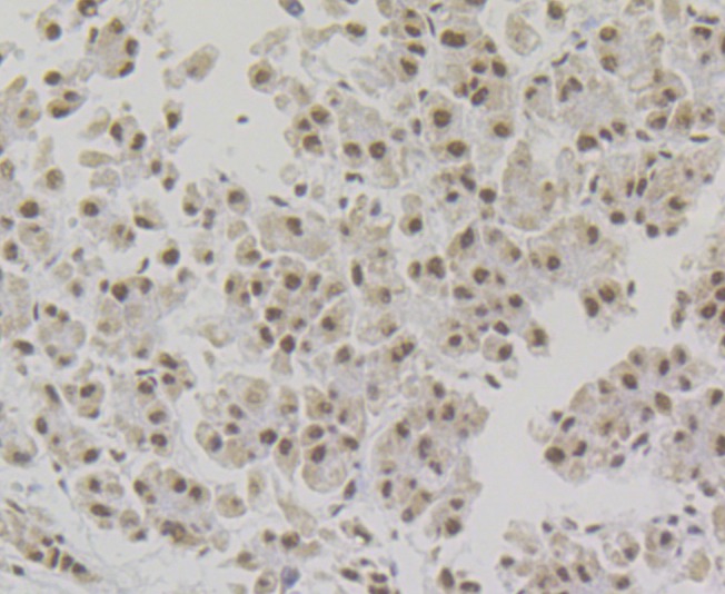 Anti-NONO Antibody (8D270)