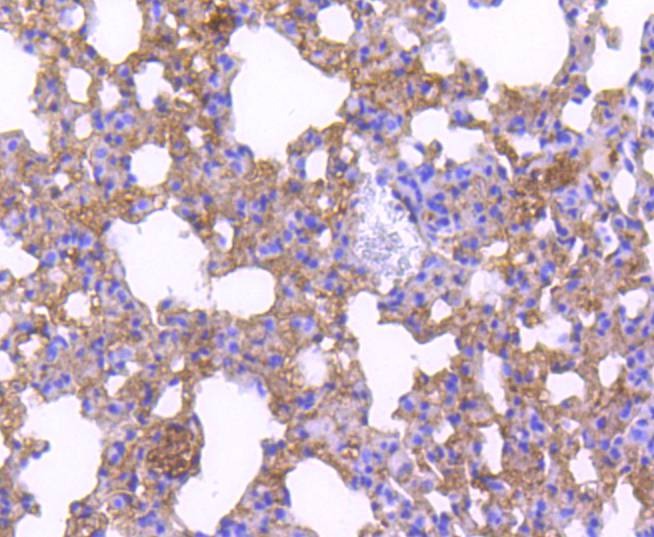 Anti-CDKN1B Antibody (9B660)