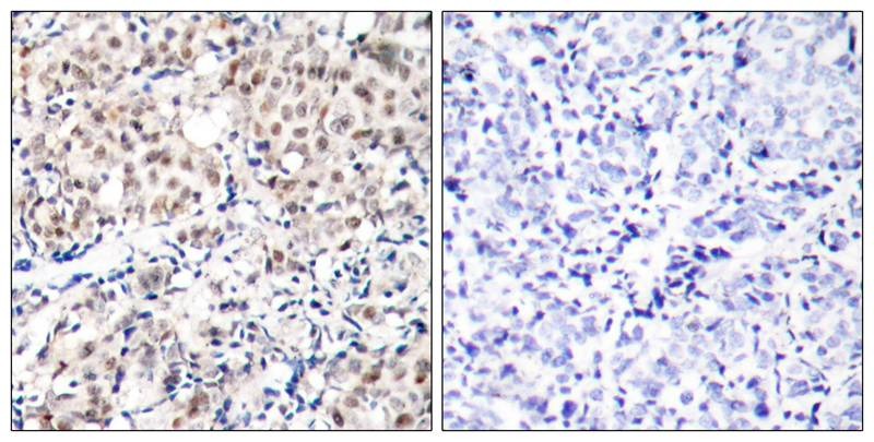 Anti-Phospho-CDKN1B (Thr187) Polyclonal Antibody
