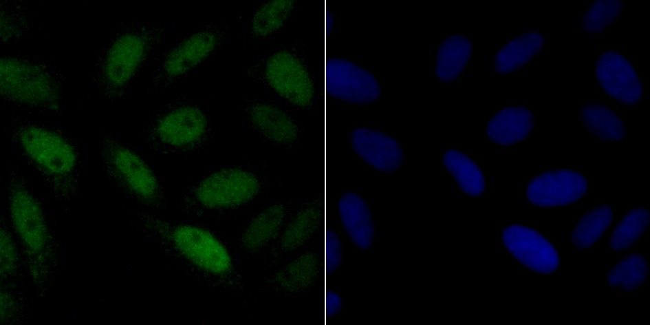 Anti-p60 CAF1 Antibody (4X99)