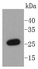 Anti-NQO2 Antibody (1E974)