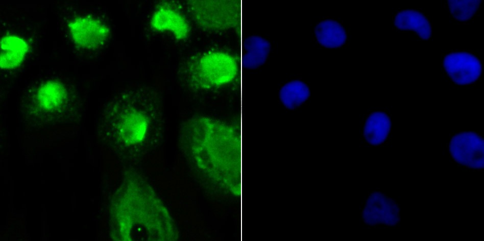 Anti-OGT Antibody (8O260)