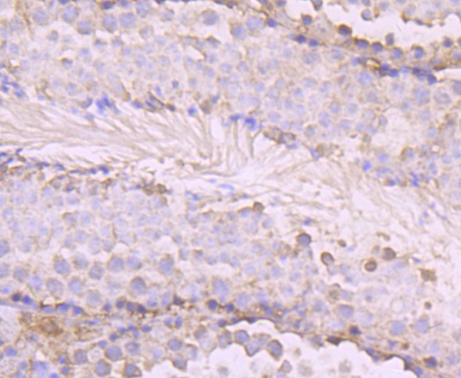 Anti-OGT Antibody (8O260)