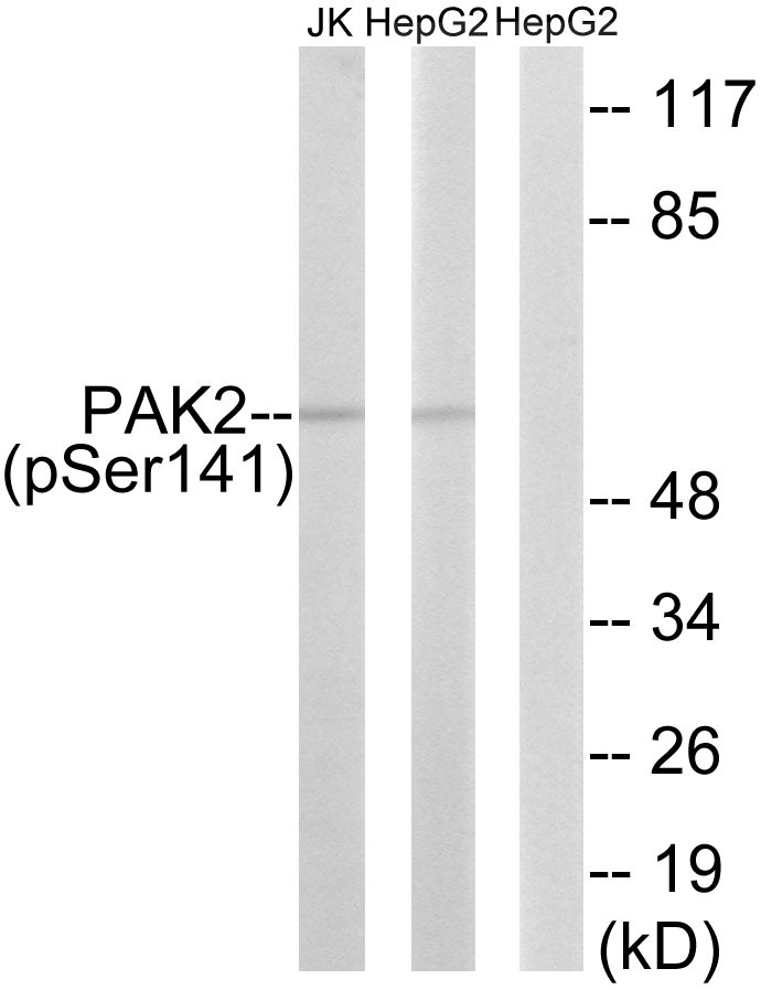 Anti-Phospho-PAK2 (Ser141) Polyclonal Antibody 2