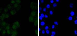 Anti-OCT4 Antibody (4Q101)