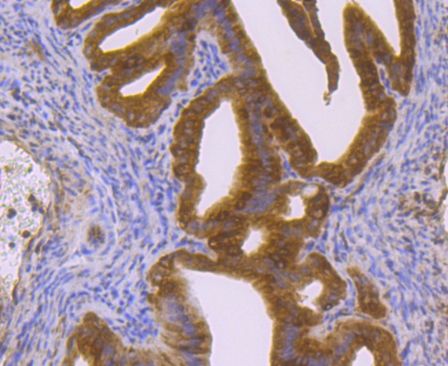 Anti-PTGES3 Antibody (3N840)