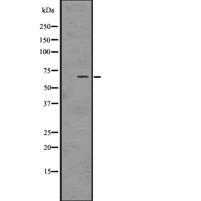 Anti-Phospho-PAK1/2/3 (Ser144/141/139) Polyclonal Antibody