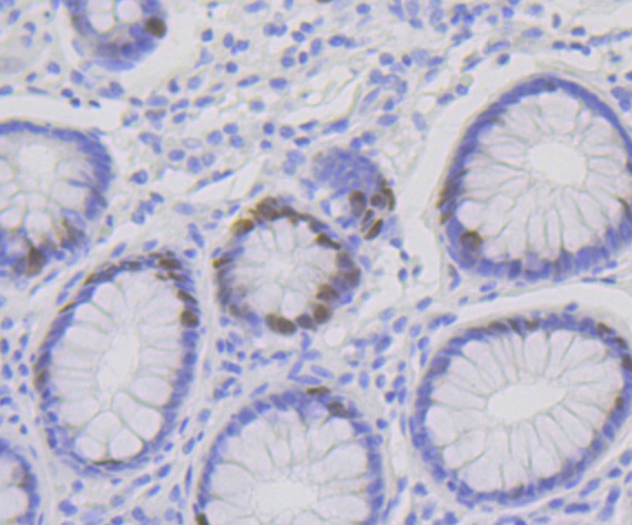 Anti-p60 CAF1 Antibody (4X99)
