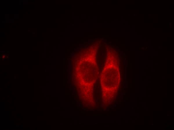 Anti-Phospho-p53 (Ser37) Polyclonal Antibody
