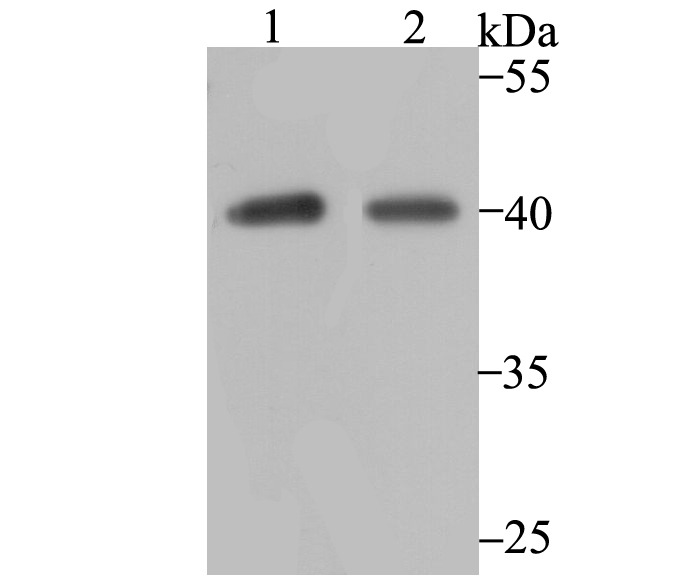 Anti-P2Y6 Antibody (7J344)