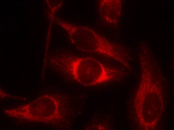 Anti-Phospho-p53 (Ser46) Polyclonal Antibody