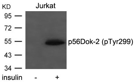 Anti-Phospho-p56 Dok-2 (Tyr299) Polyclonal Antibody