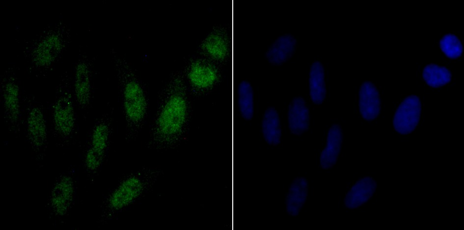 Anti-NONO Antibody (8D270)