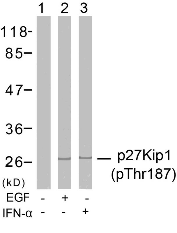 Anti-Phospho-CDKN1B (Thr187) Polyclonal Antibody