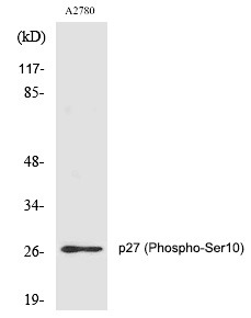 Anti-Phospho-CDKN1B (Ser10) Polyclonal Antibody